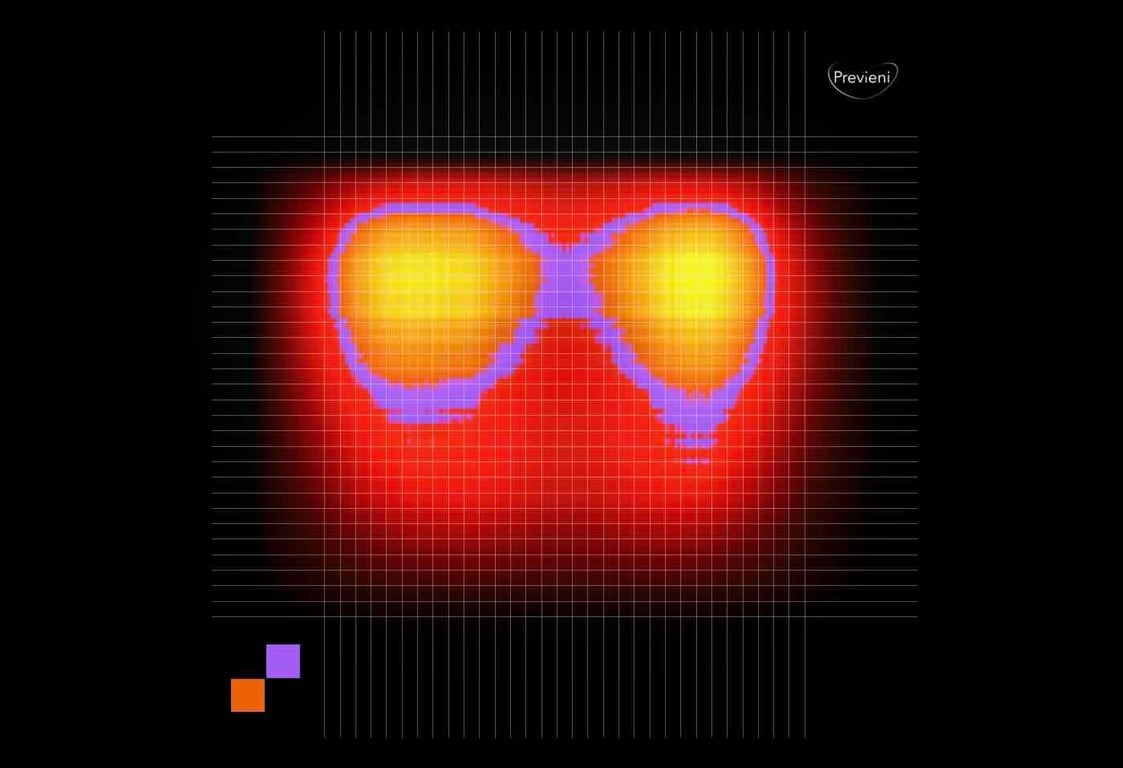 The image shows in different colors the tissue content in the wrist (in yellow the ulna and radio bones, in purple the inter-osseous membrane)
