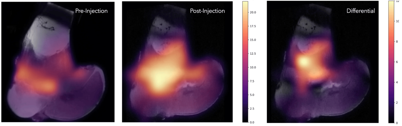 Rilemo fusion with MRI Images, sagittal view. On the left, a healthy knee without edema, but with fluids connected to the young age of the bovine. In the centre, the same knee with 5 mL of edema-simulating fluid. On the right, the differential between the previous pictures.