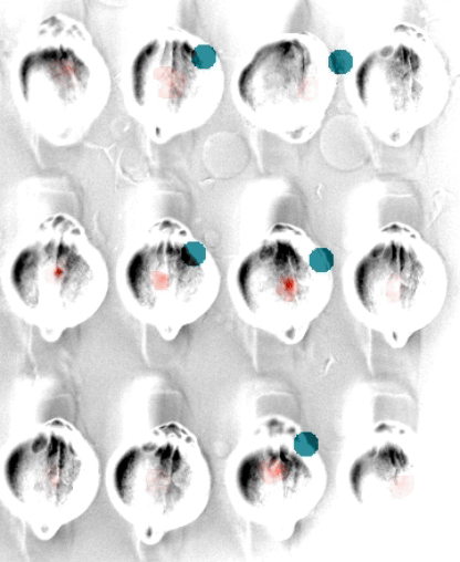 Parallelized optogenetic control of cardiac calcium dynamics and visualization using a redshifted calcium sensor (adapted from Jia et al. Nature 2023). 