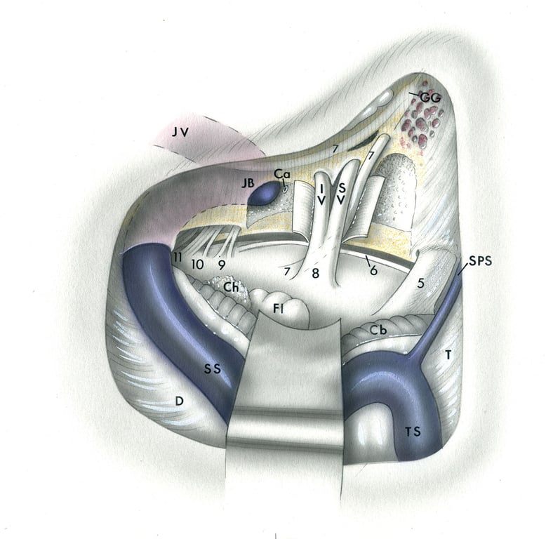 TS, transverse sinus - SS, sigmoid sinus - JB, jugular bulb - JV, jugular vein - SPS, superior petrosal sinus - IV, inferior vestibular nerve - SV, superior vestibular nerve - Fl, flocculus - Ch, choroid plexus - Cb, cerebellum - D, dura - Ca, cochlear aqueduct orifice - GG, geniculate ganglion - 5, trigeminal nerve - 7, facial nerve - 8, audiovestibular nerve - 9, glossopharyngeal nerve - 10, vagus nerve - 11, accessory nerve.
