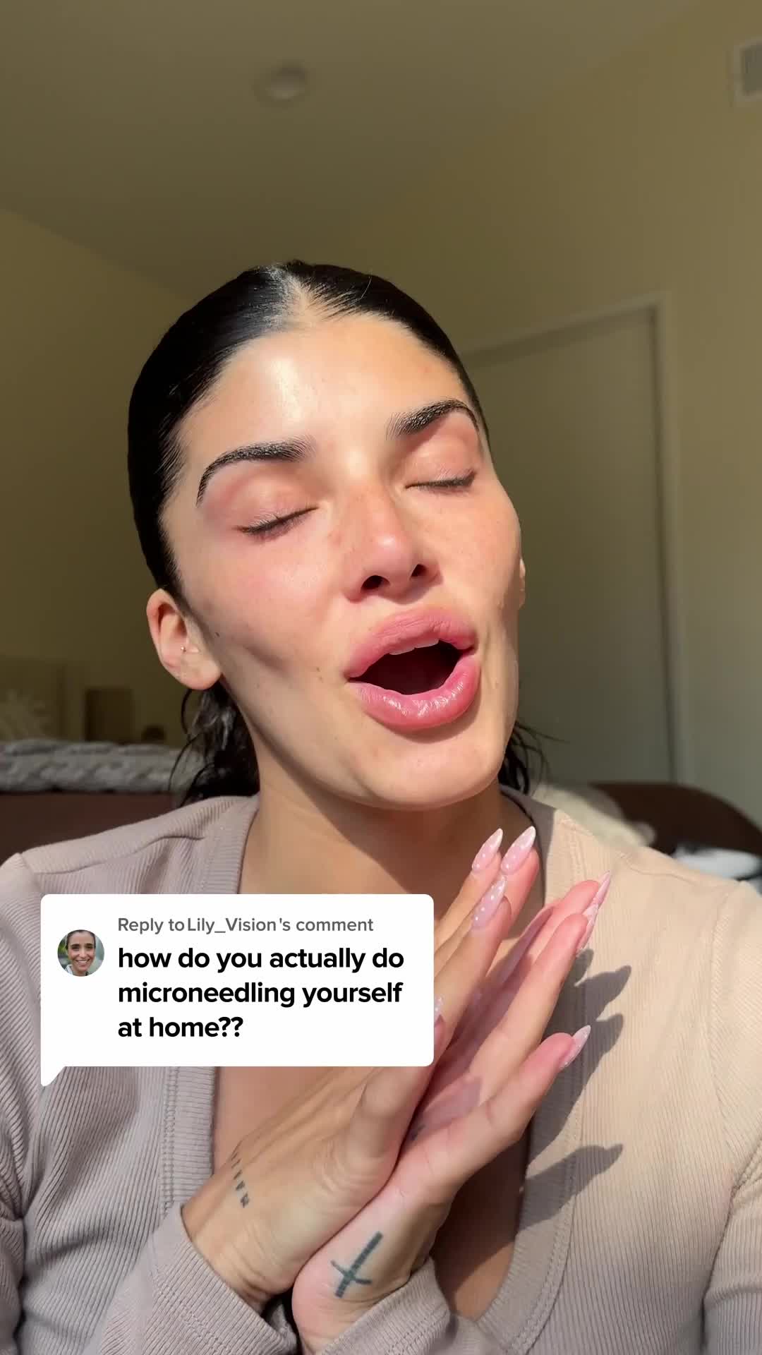 Microneedling at Home: Start Skincare Journey Now