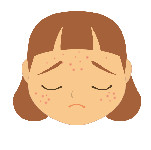 image for [FREE] 3 Cara Pengobatan untuk Hempaskan Jerawat button