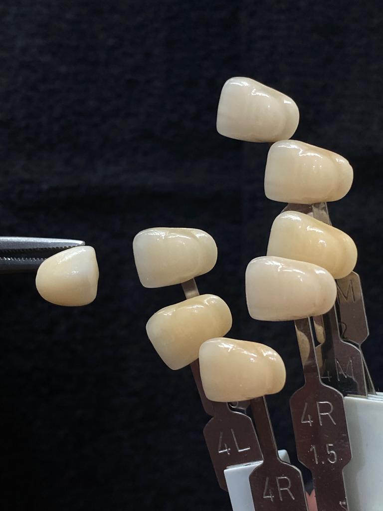 Image for Handmade Teeth and Matching Color