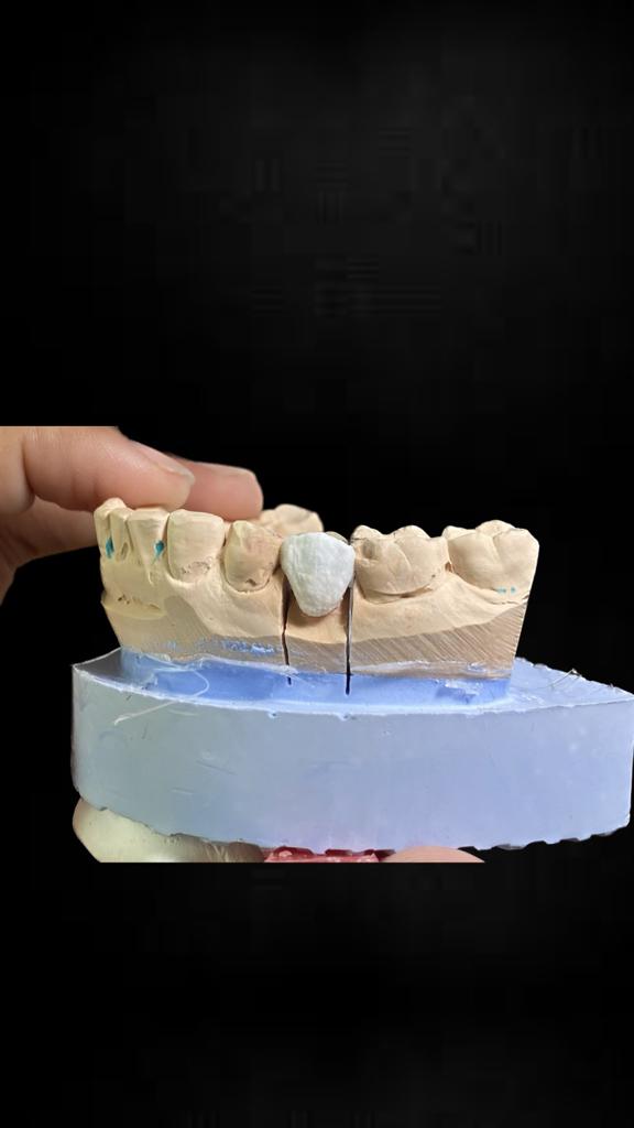 Image for Handmade Teeth and Matching Color