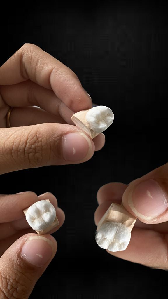 Image for Handmade Teeth and Matching Color