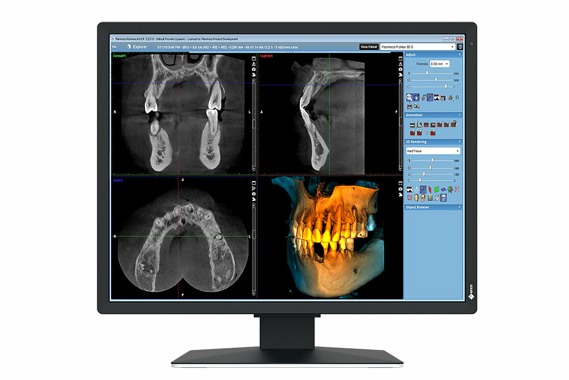 EIZO RadiForce MX217 SB écran plat de PC 53 3 cm 21 1200 x 1600 pixels UXGA LCD Neuf