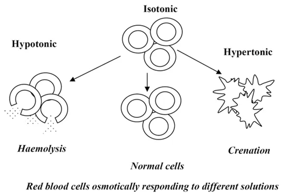 Diagram showing red blood cells responding to different osmotic environments: in a hypotonic solution cells swell and burst causing haemolysis, in an isotonic solution cells remain normal, and in a hypertonic solution cells shrink and become spiky through crenation.