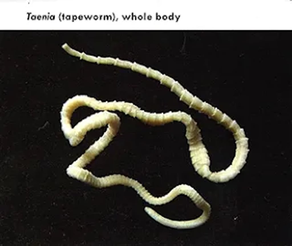 Taenia tapeworm showing its long, flat, segmented white body against a dark background, representing the parasitic structure of the adult worm.