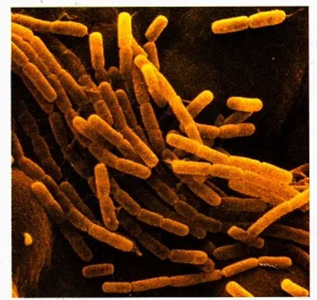 False-color electron micrograph showing many rod-shaped Bacillus cereus bacteria clustered together on a dark background.