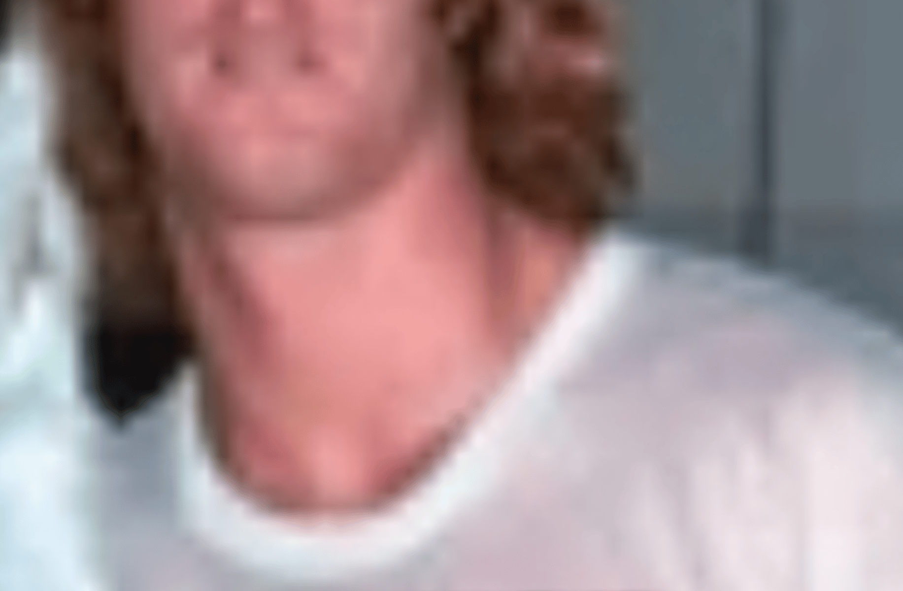 David Von Erich