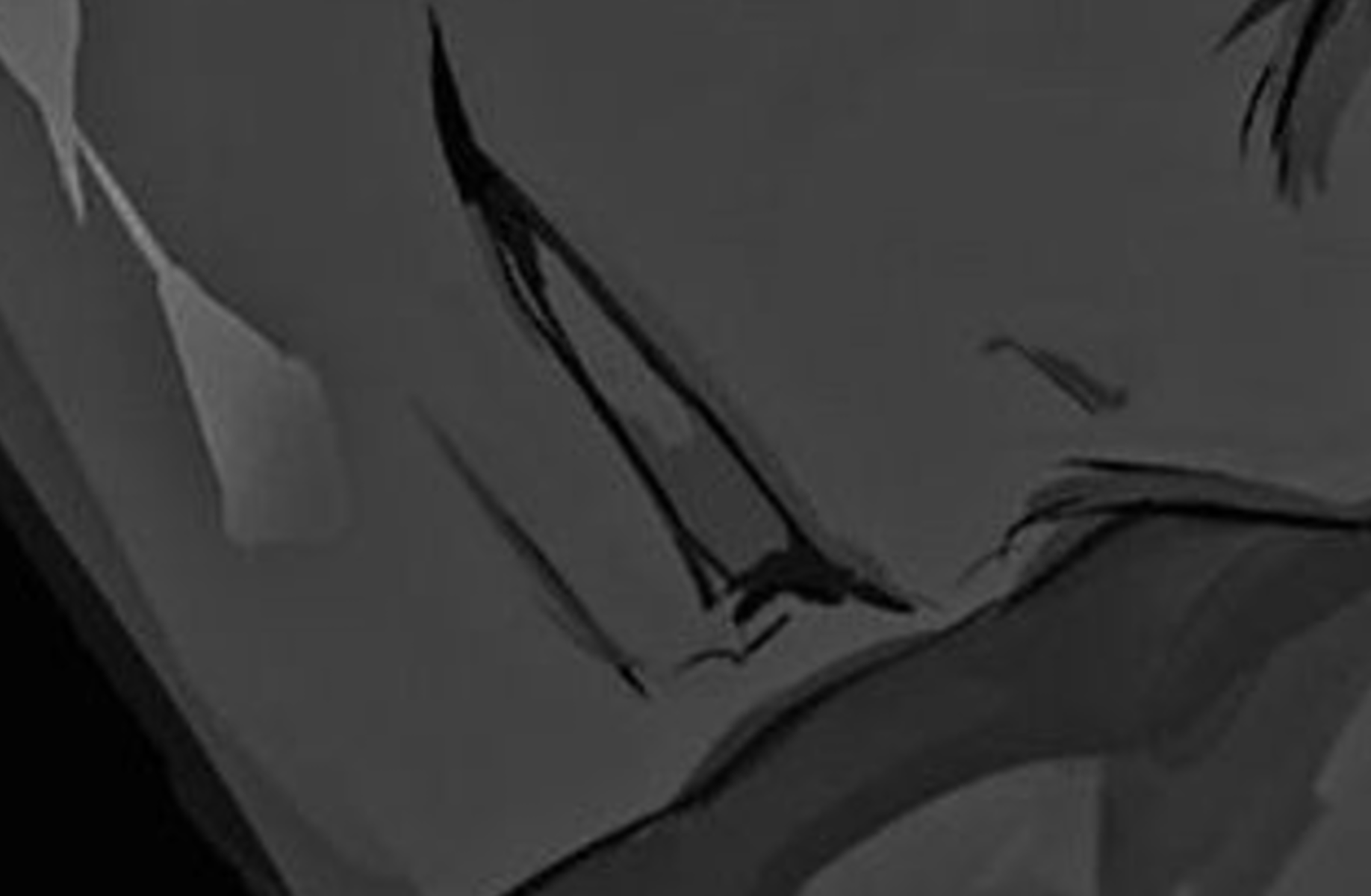 Jack