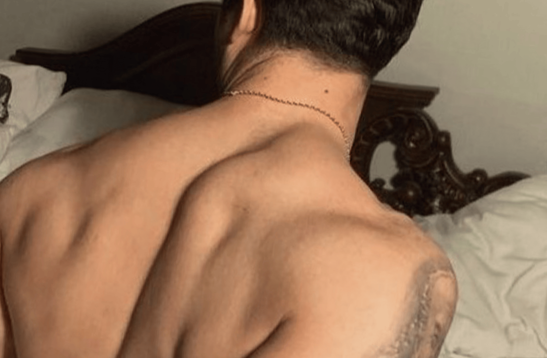 mattheo riddle