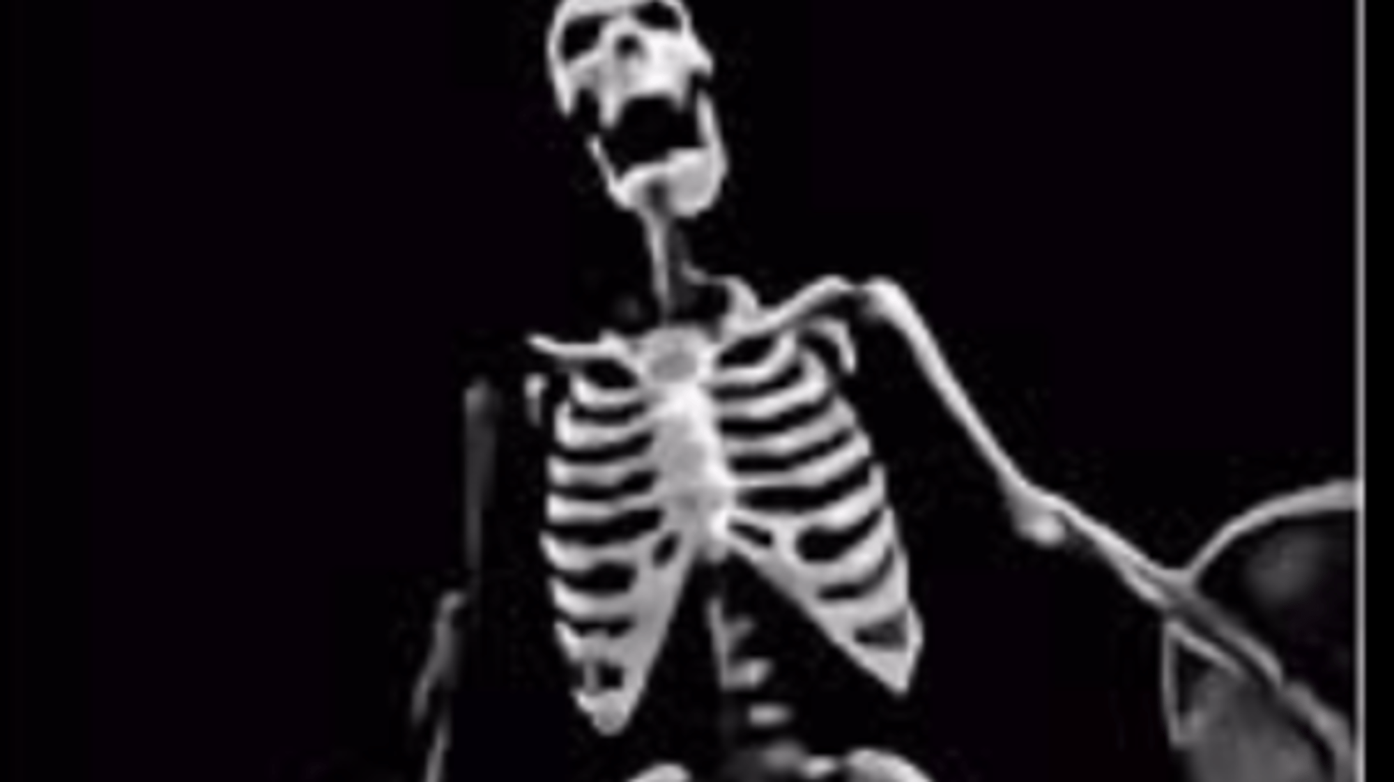 Screaming skeleton