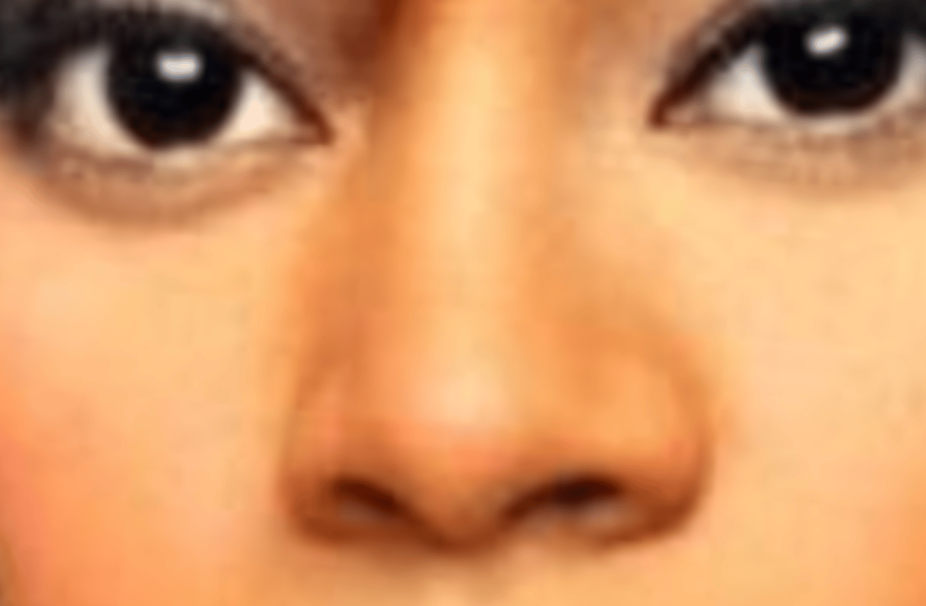 Left eye