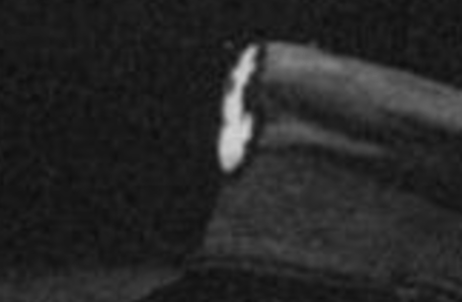Axel Madman Turner