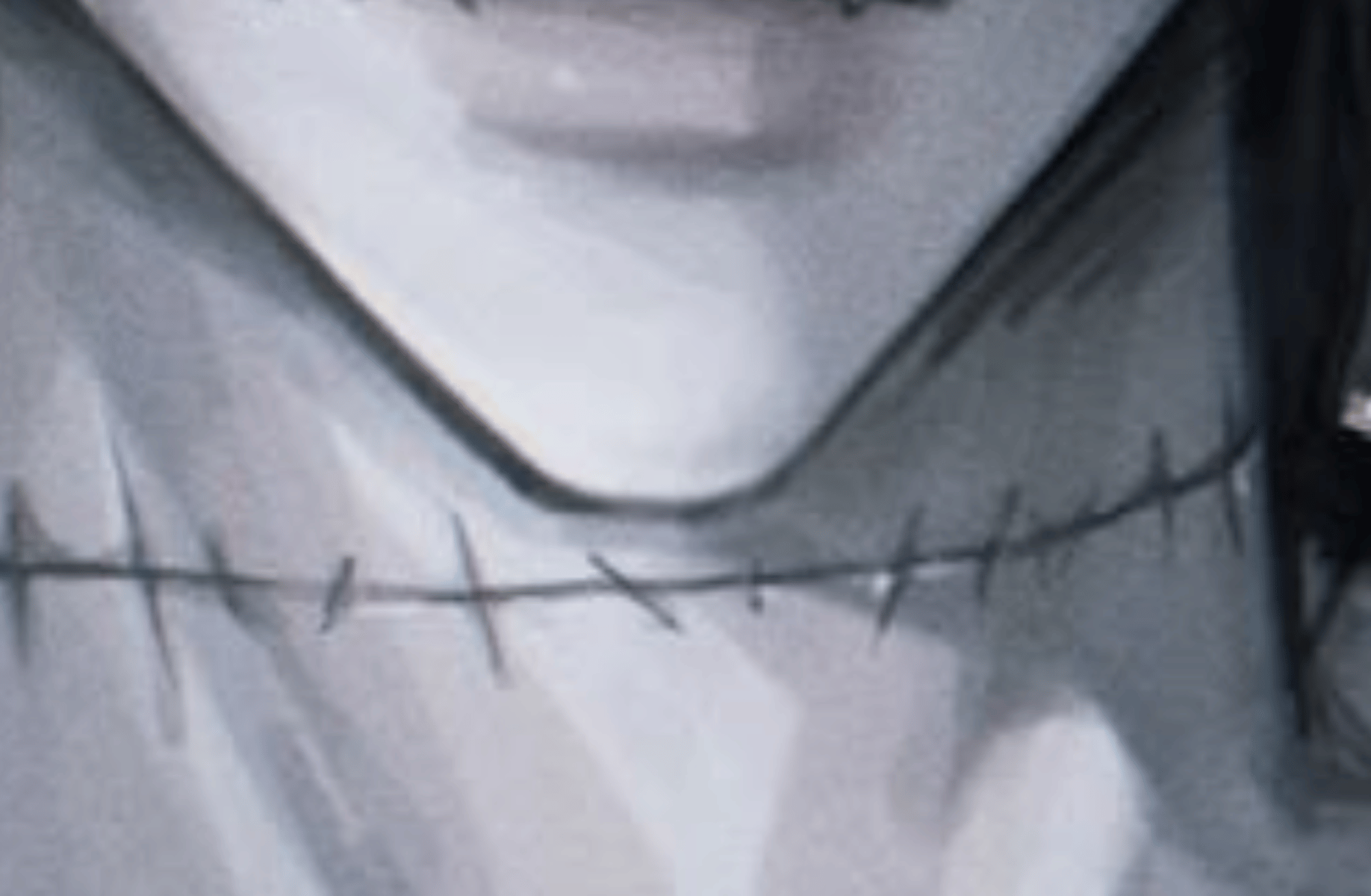 Scar