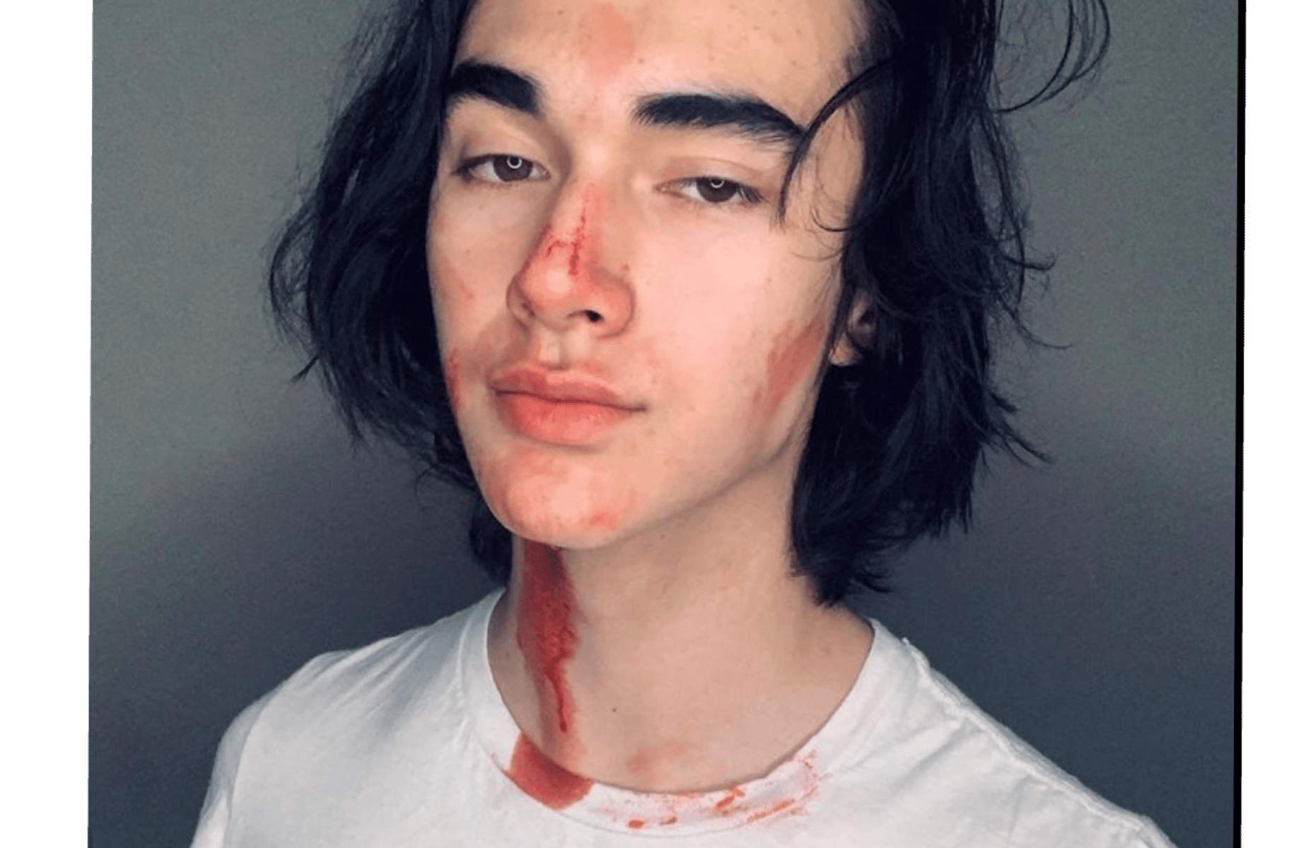 Brandon bleeding dad