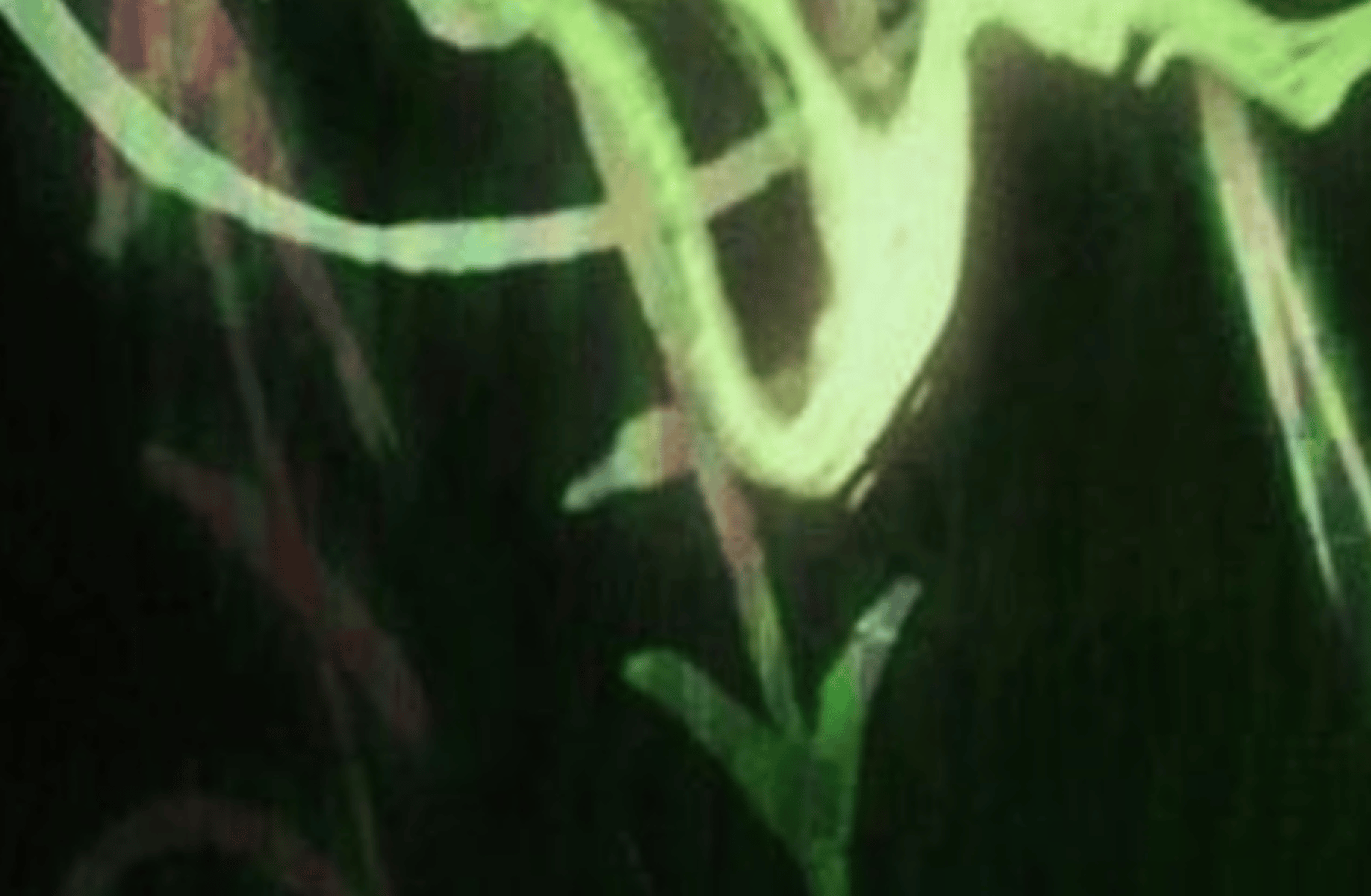 Alastor