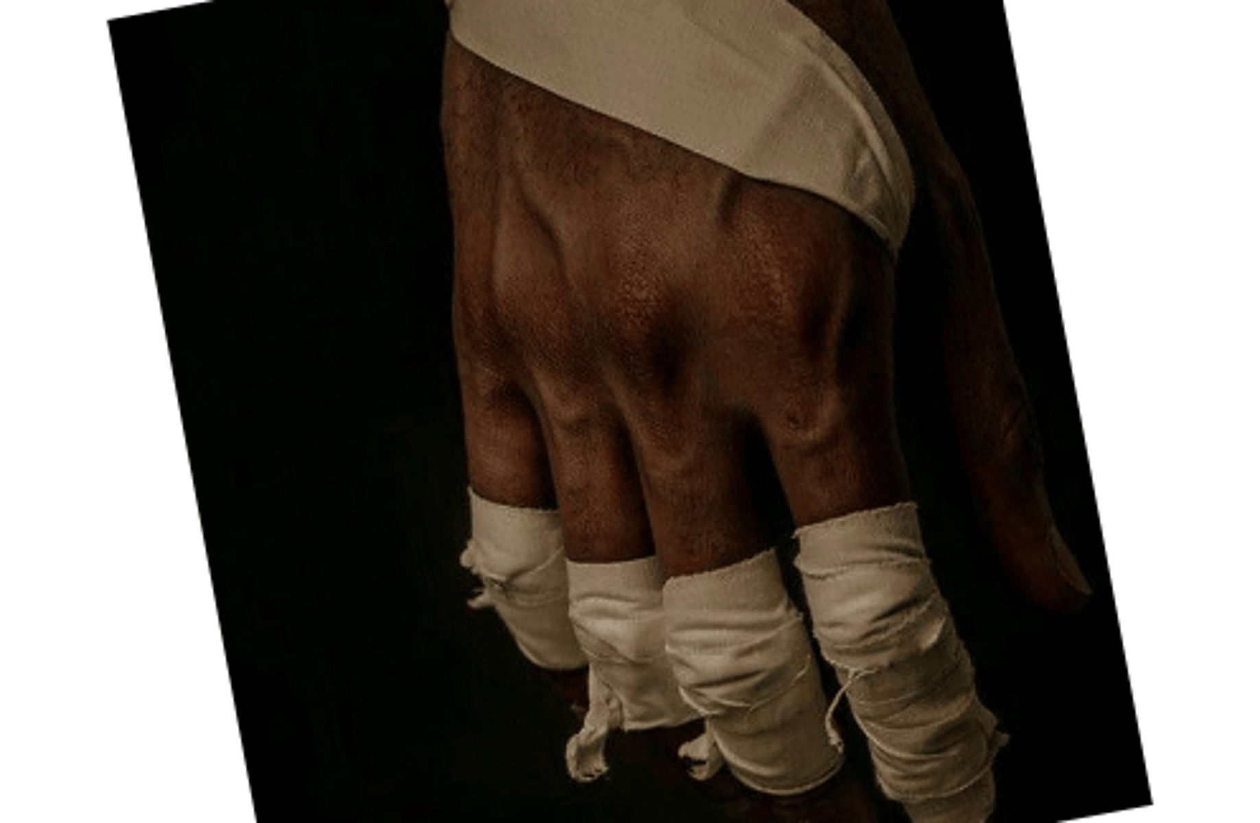 Ace