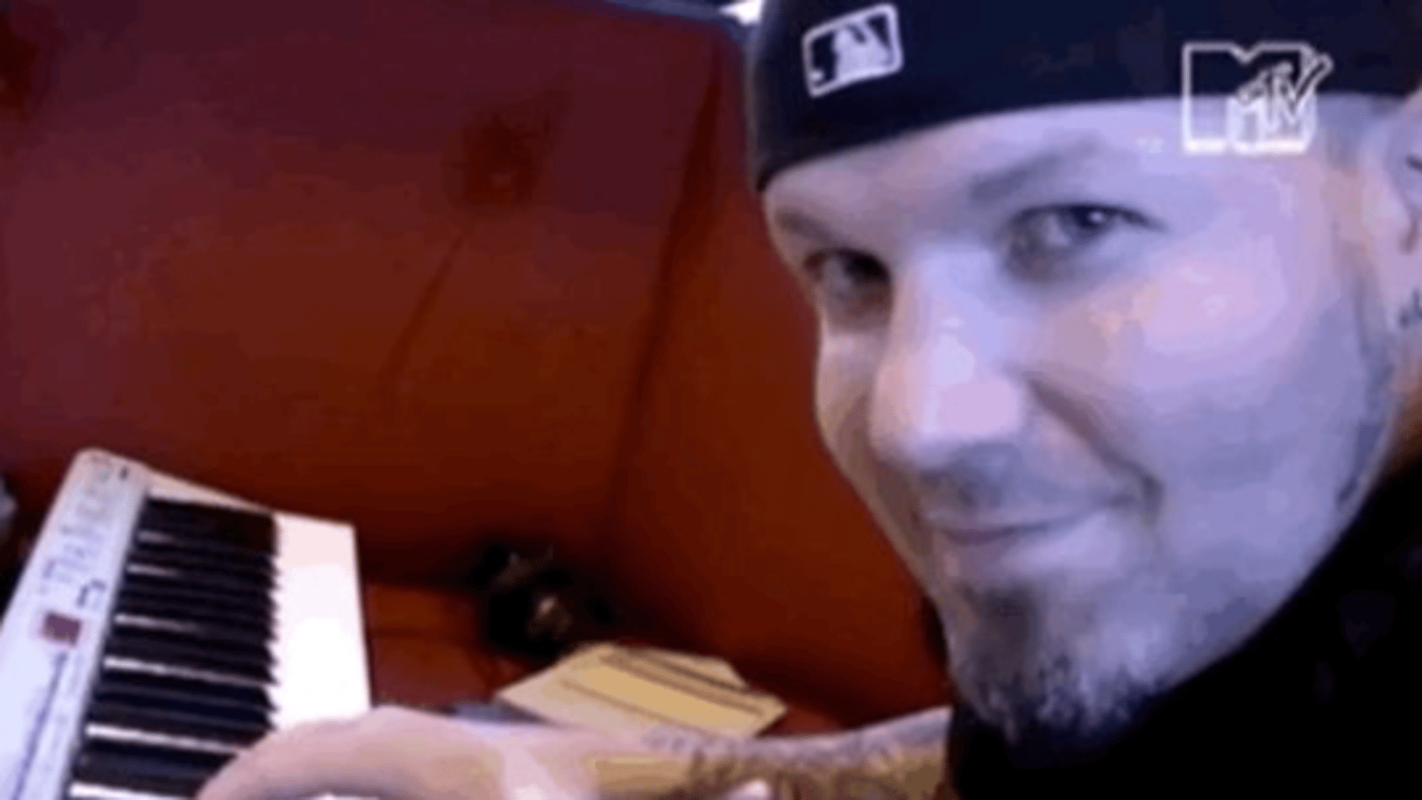 Fred Durst