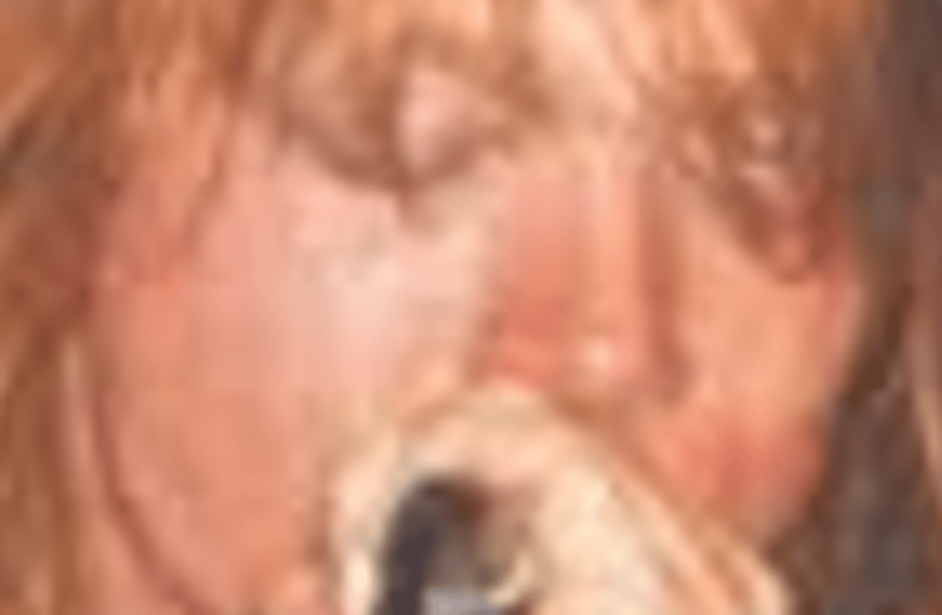 Axl Rose
