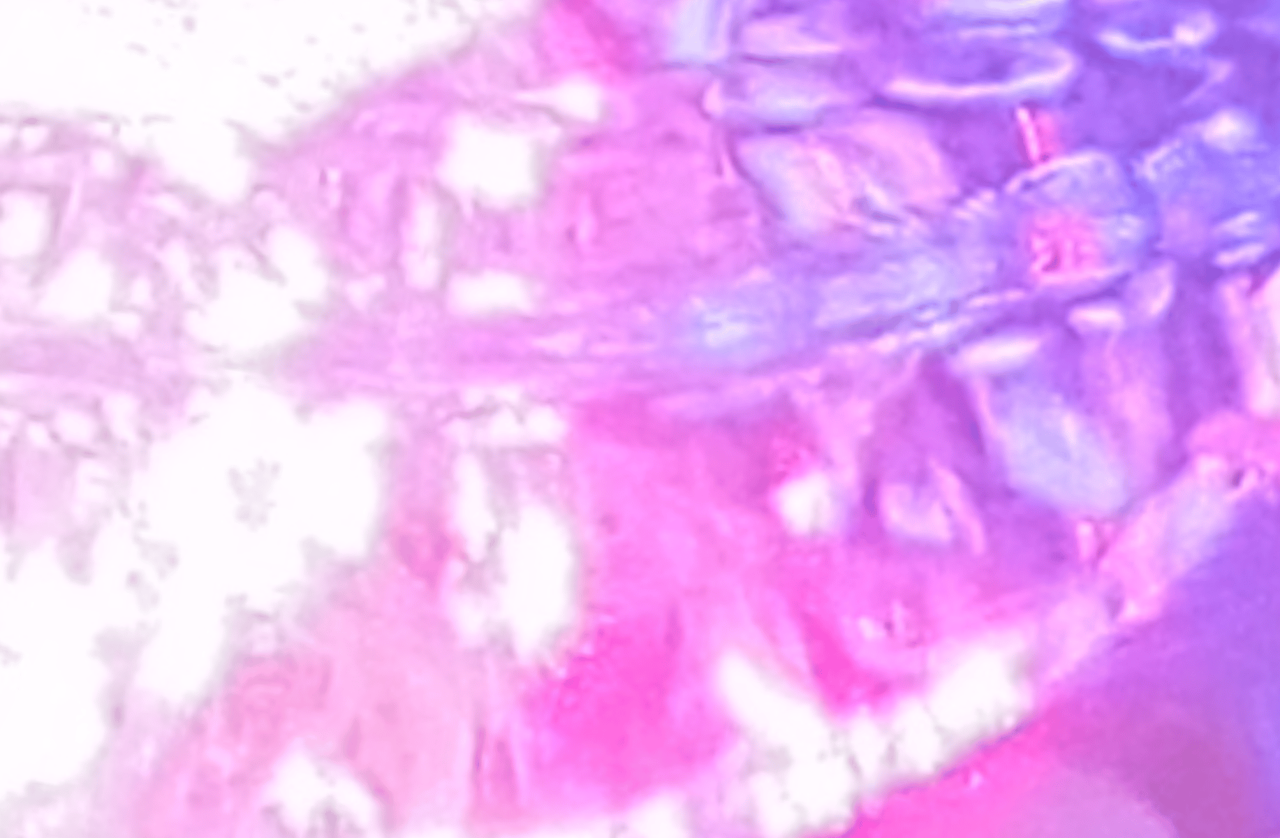 Corrupted white