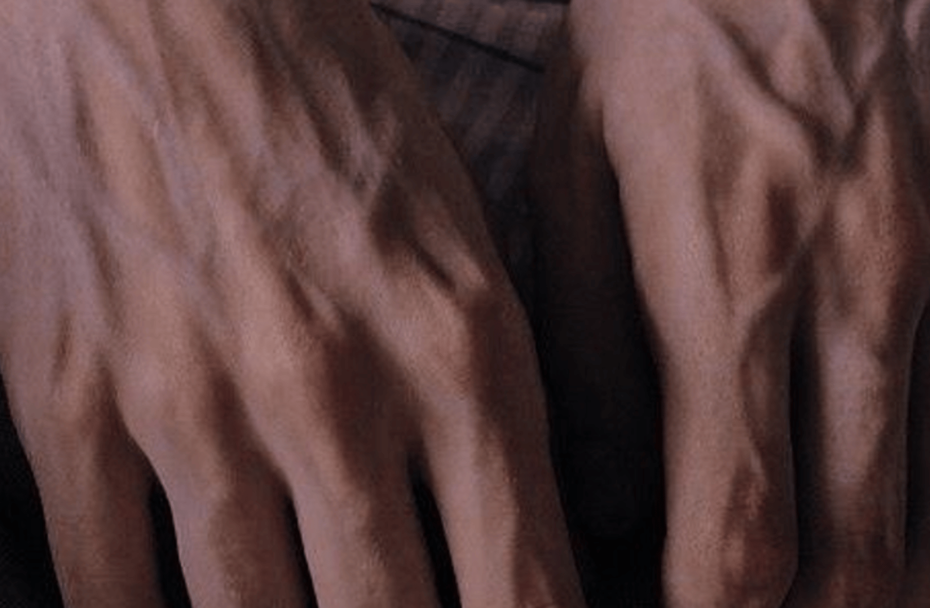 Remus Lupin