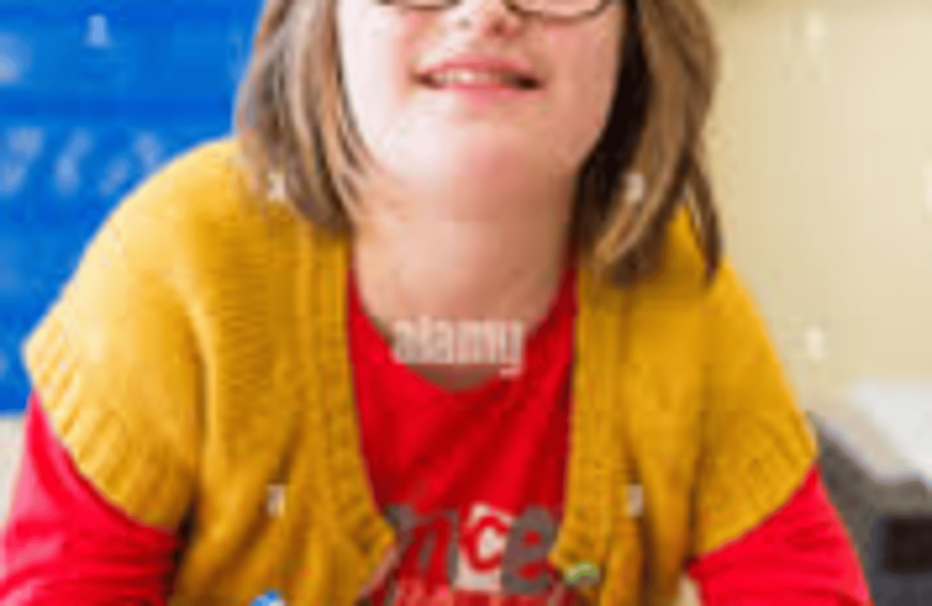Down syndrome girl