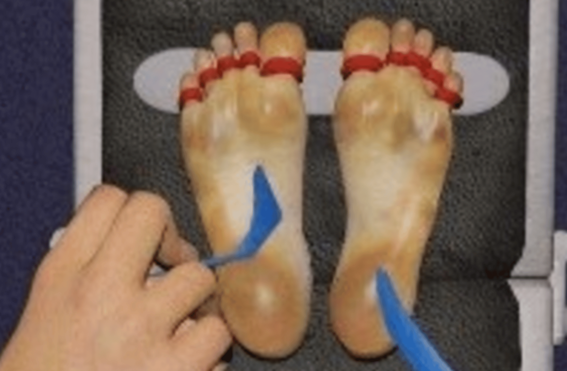 Tickling Center