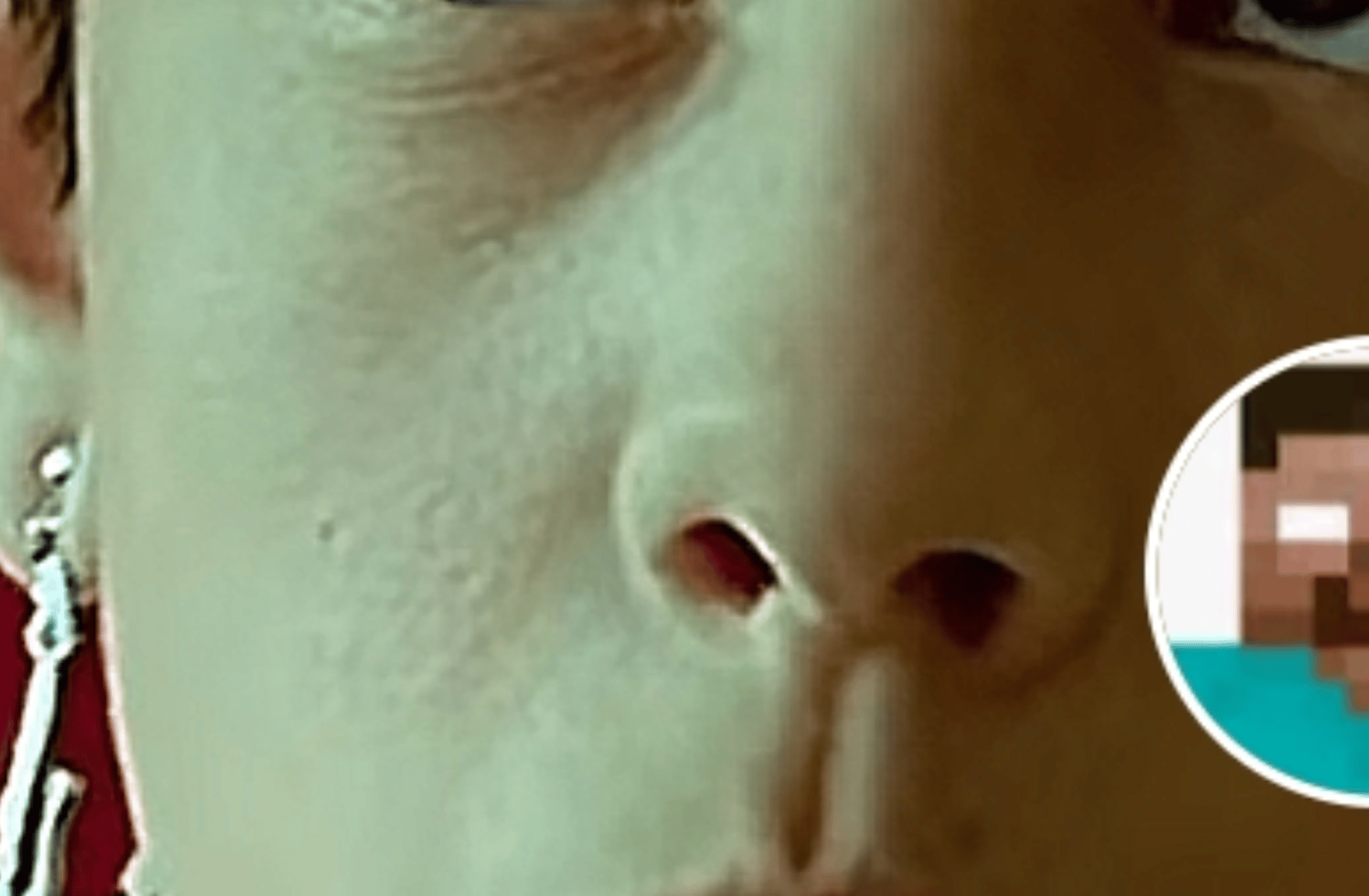 Zach