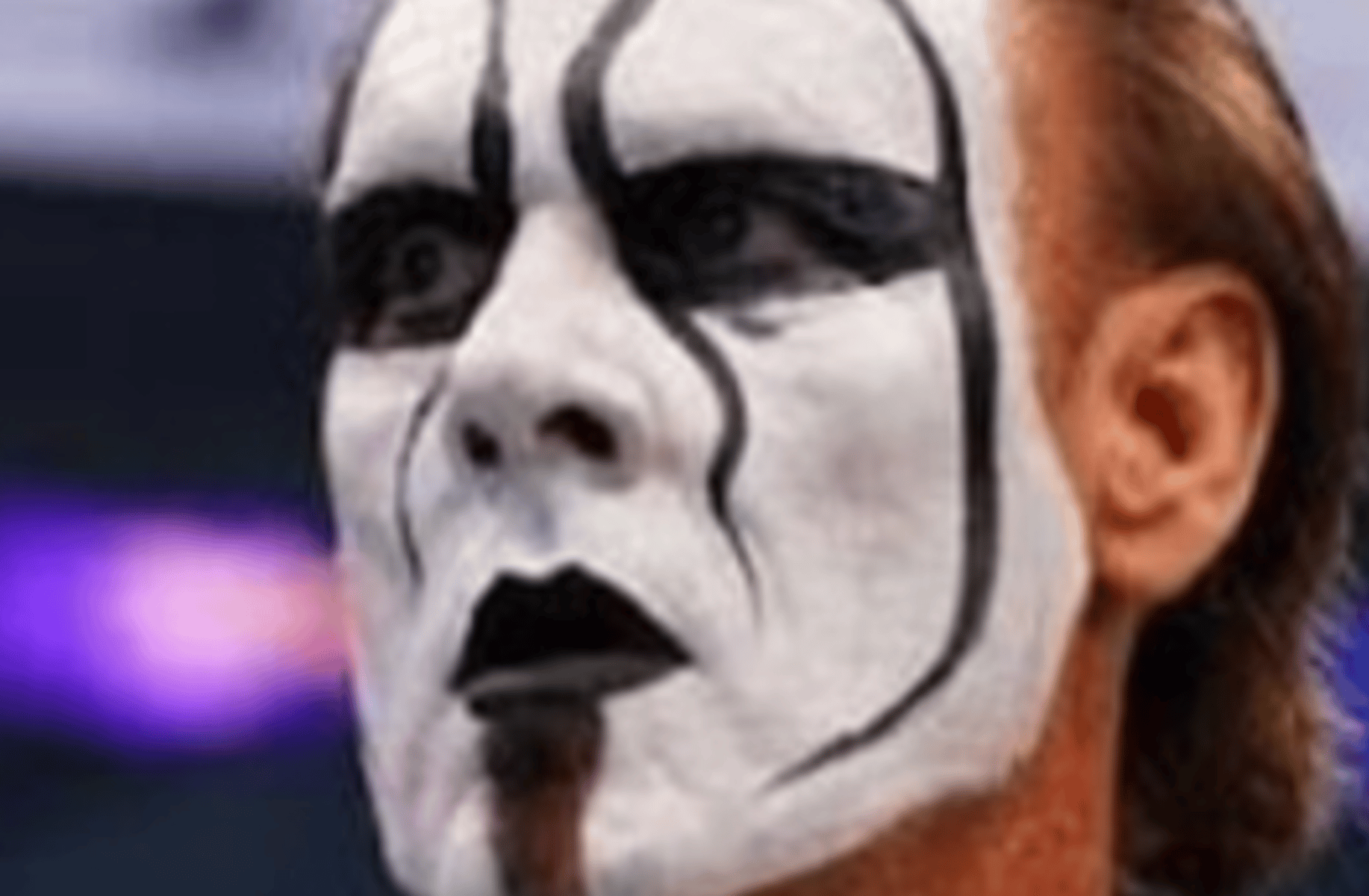 Sting