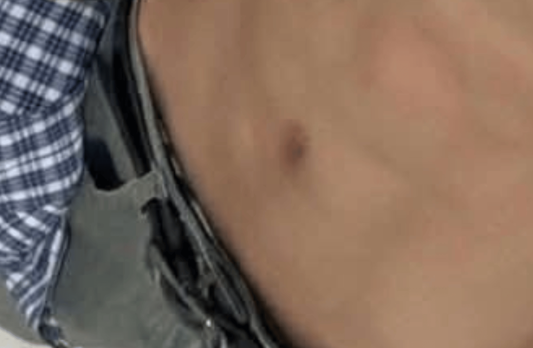 Fin
