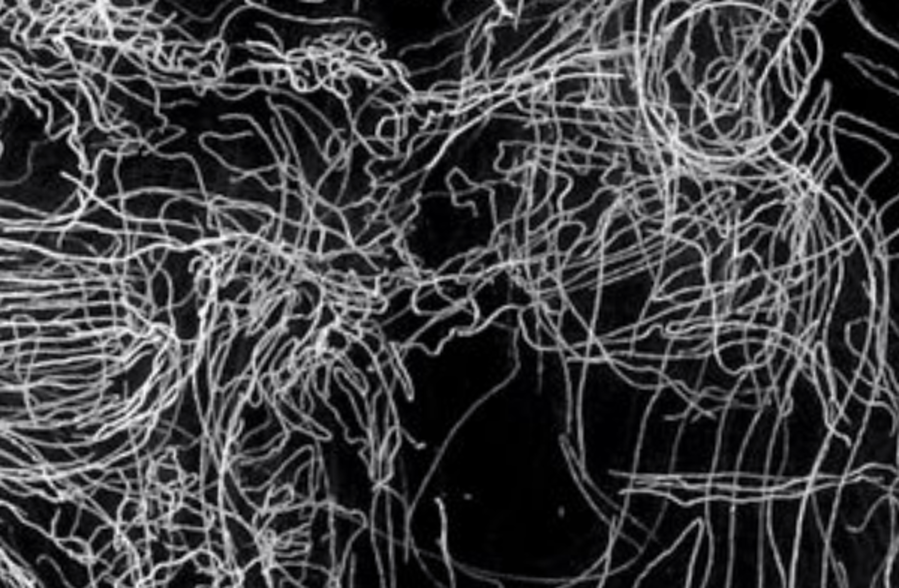 Angee (Mental Health)