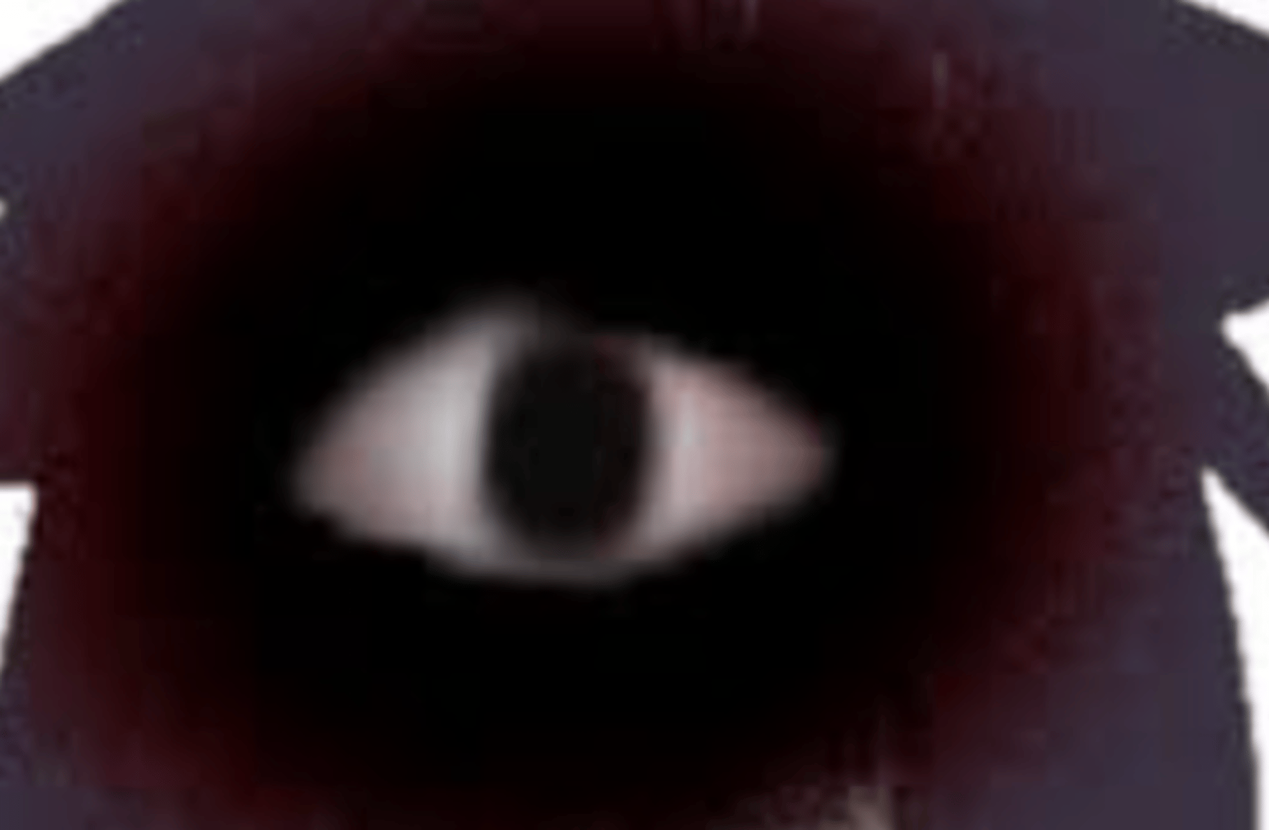FPE INFECTION AU