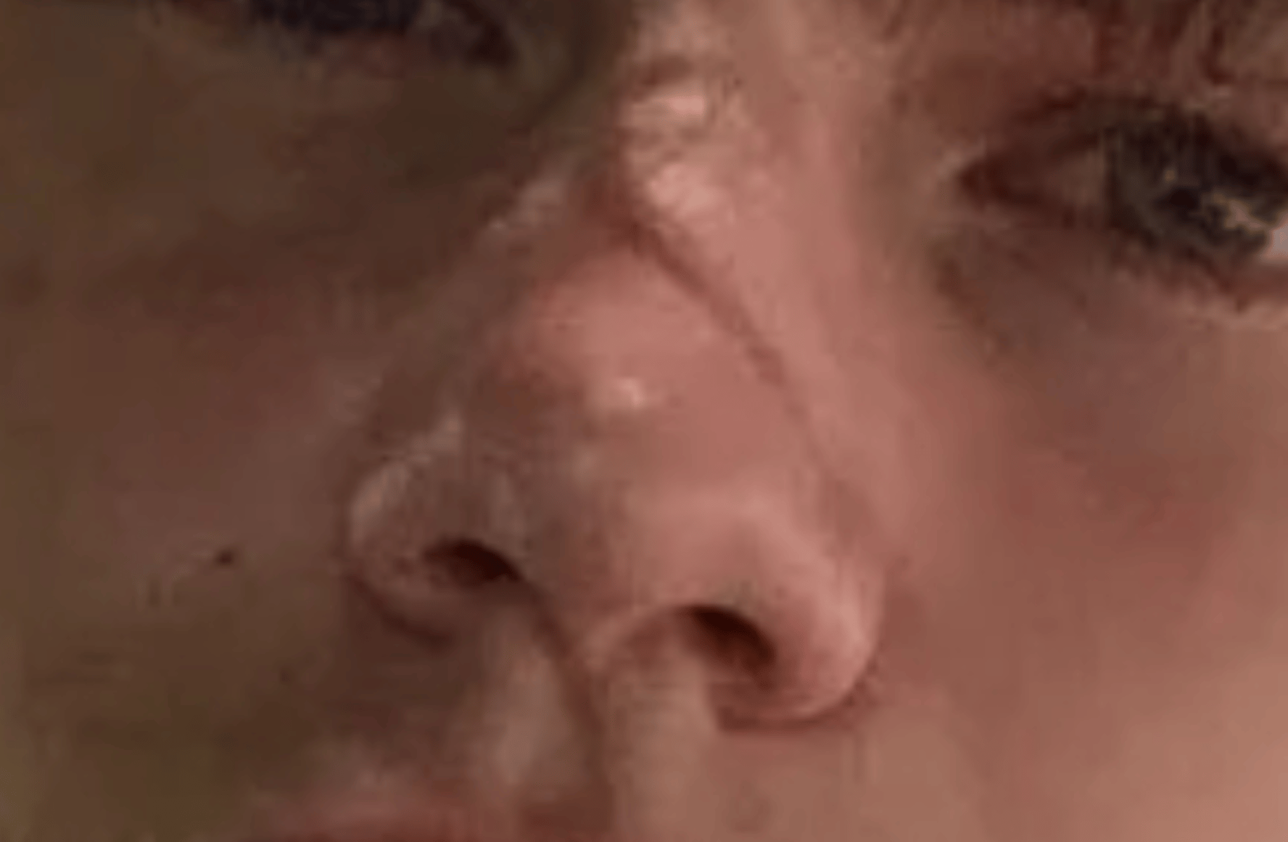 Nick