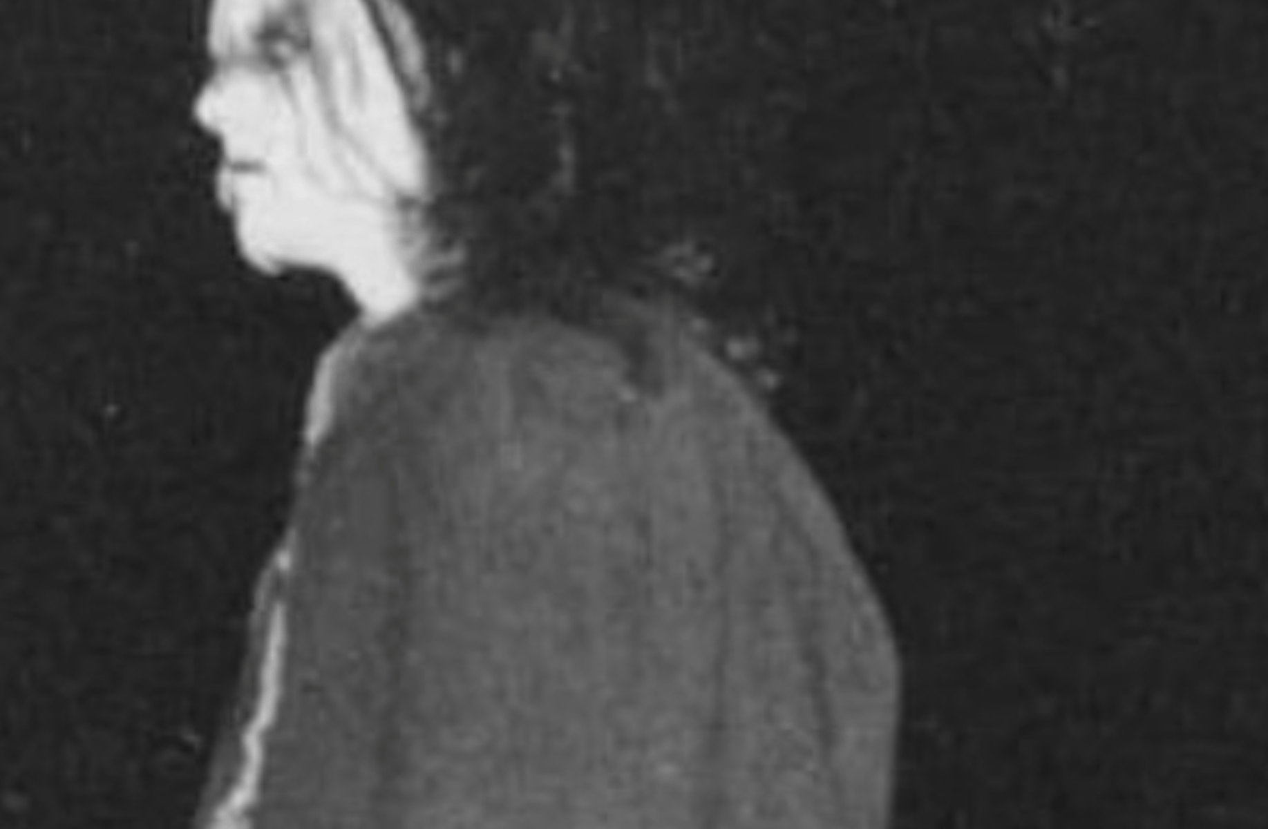 Euronymous
