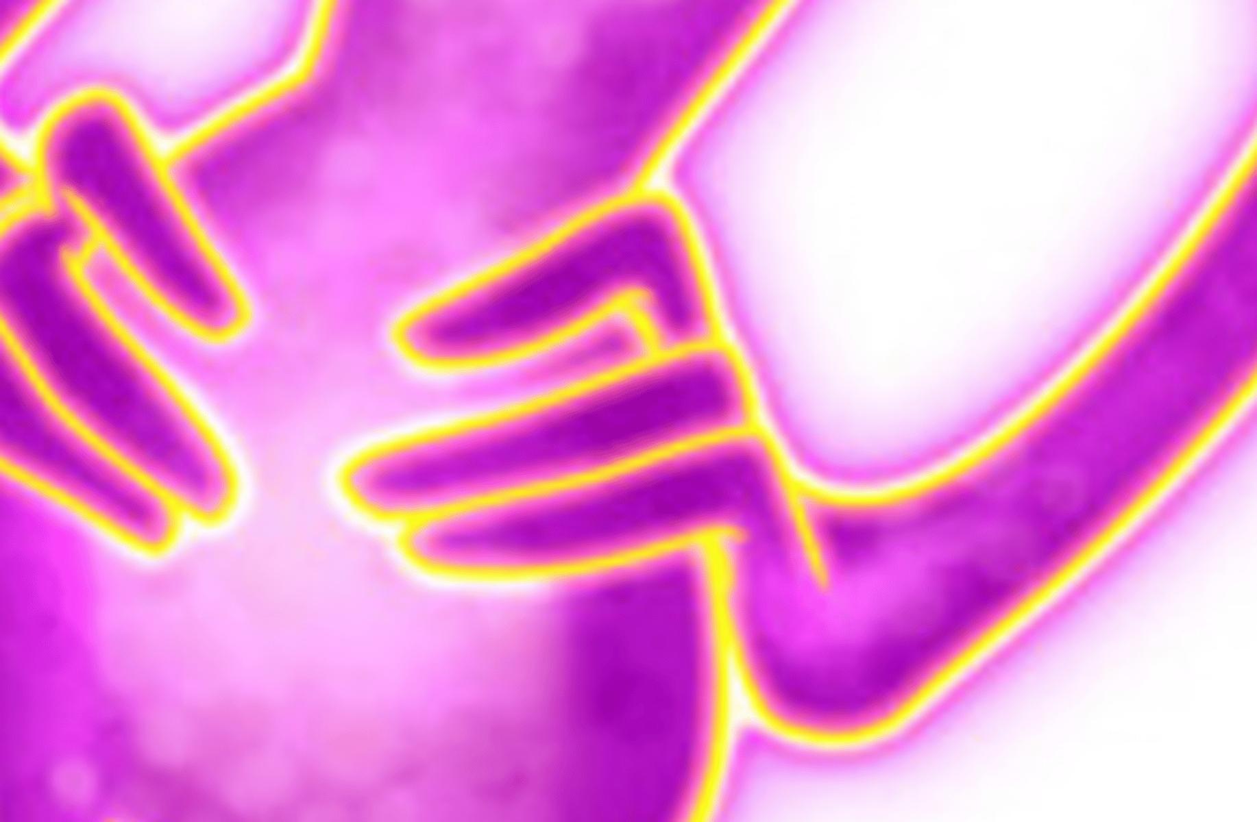 Ms splosion man