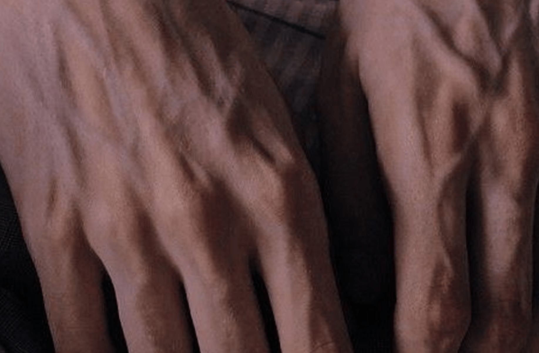 Remus Lupin