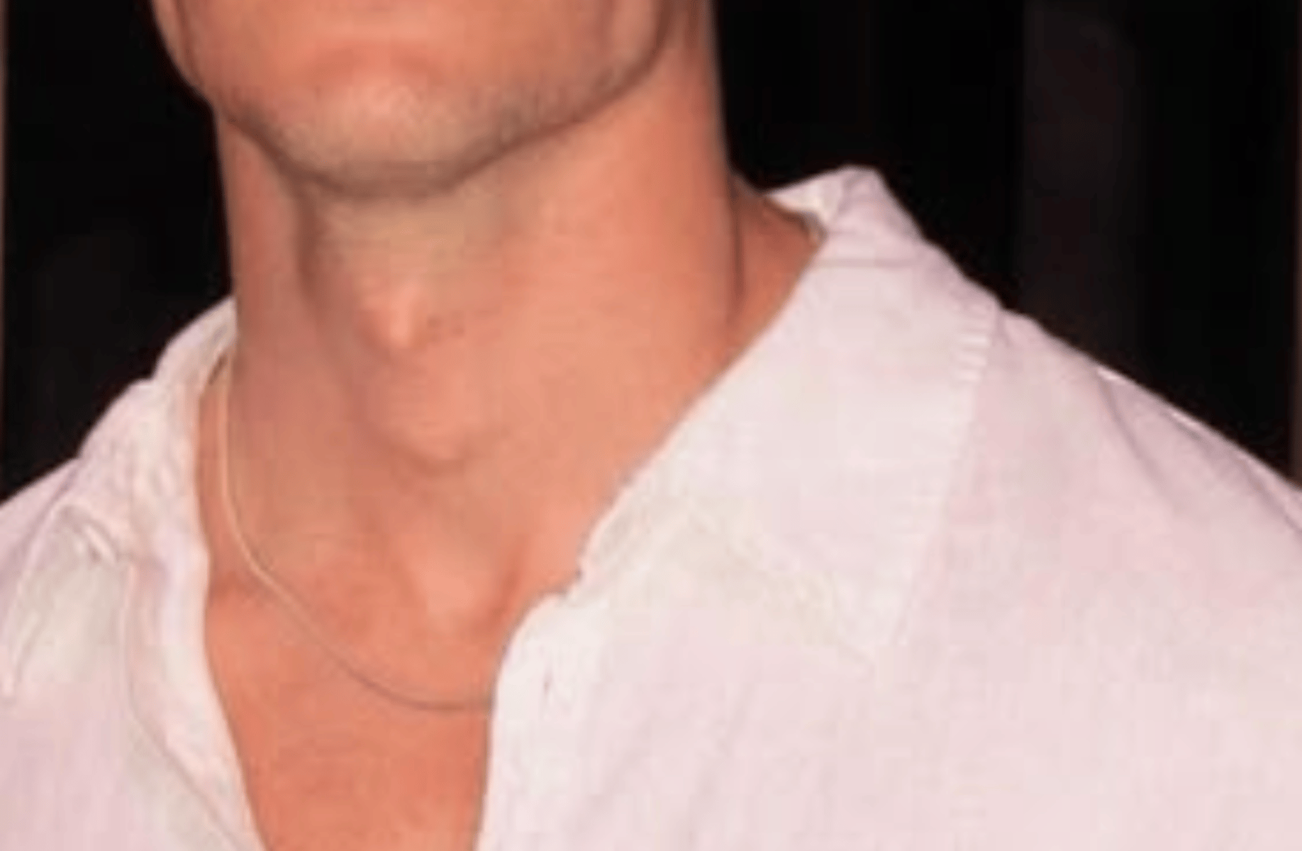 Mark