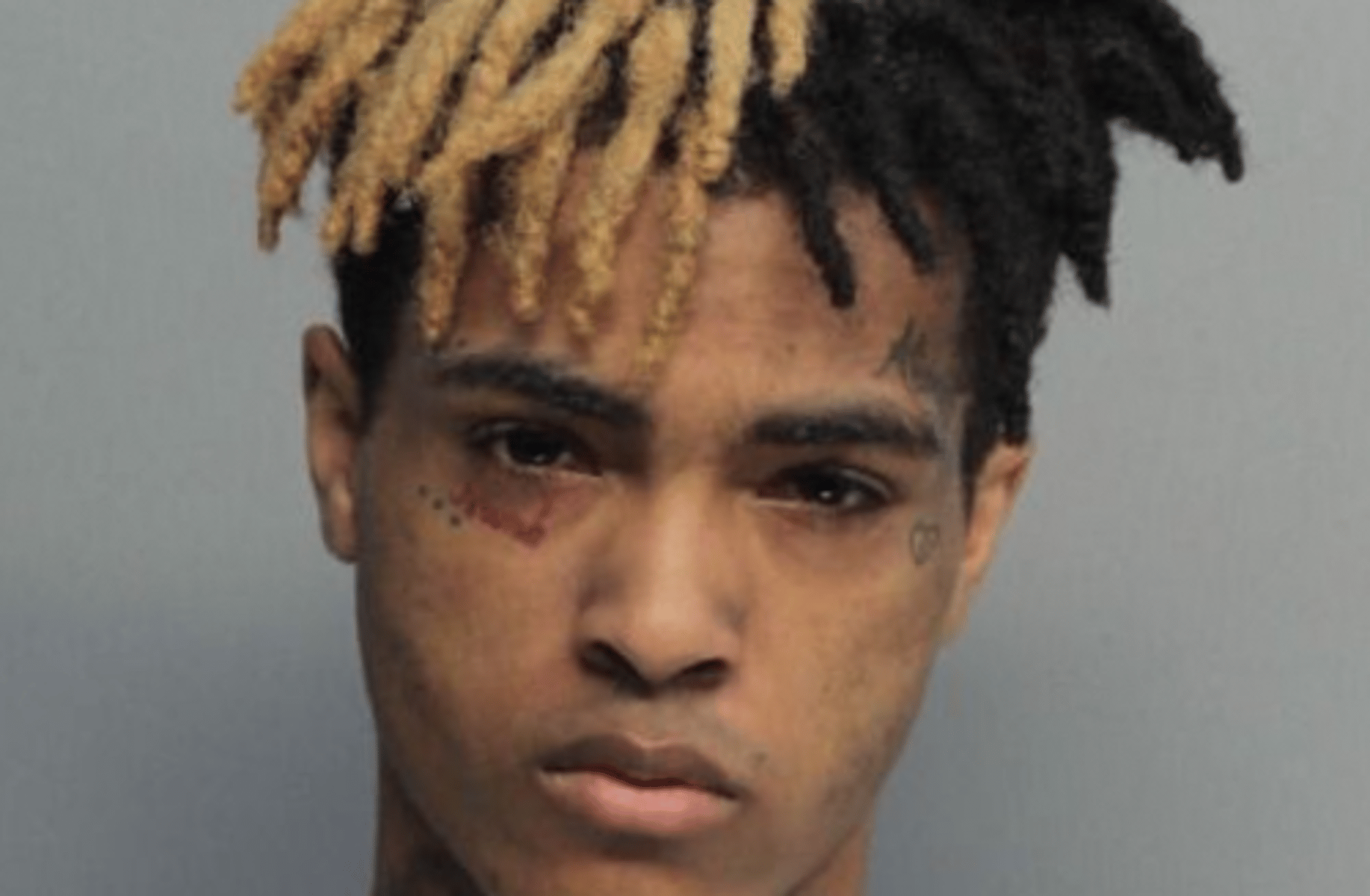 XXXTENTACION