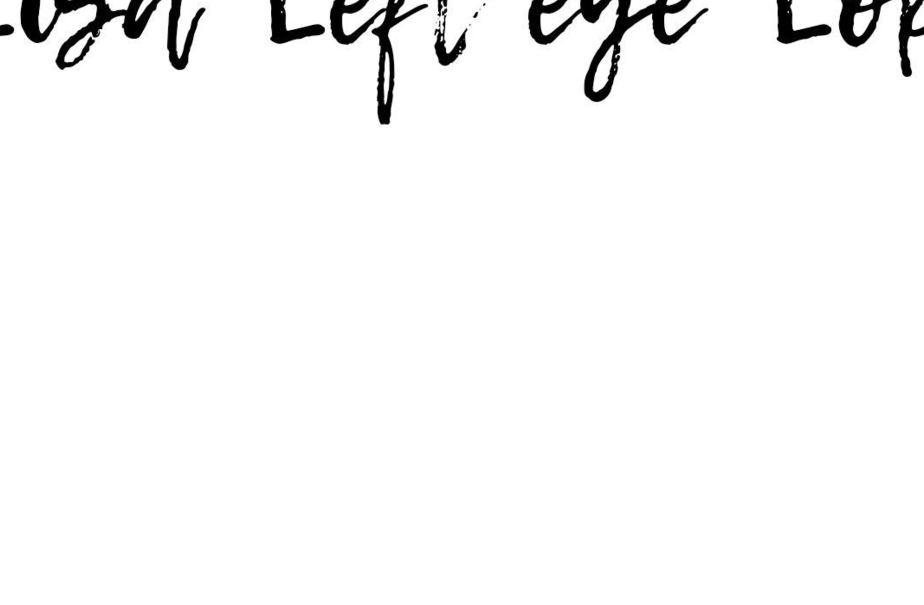 Left eye
