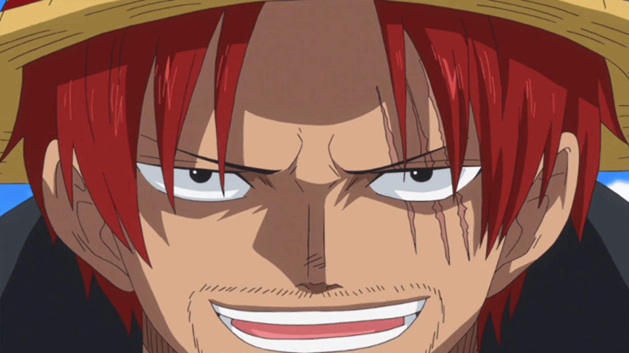 Shanks (pre-arm loss)