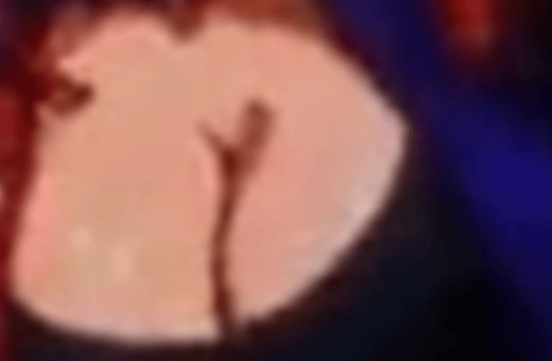 Misato