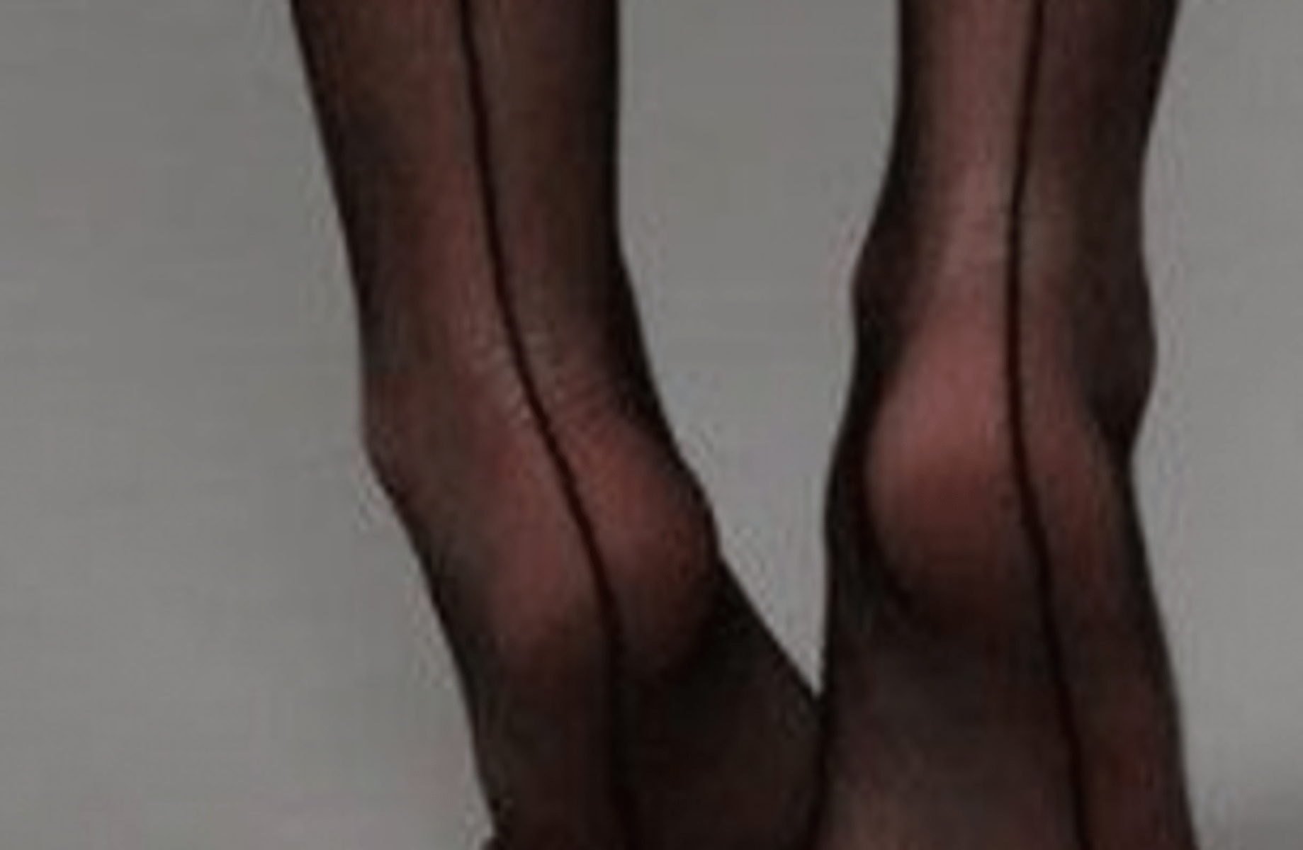 Arlecchino(foot fetish)