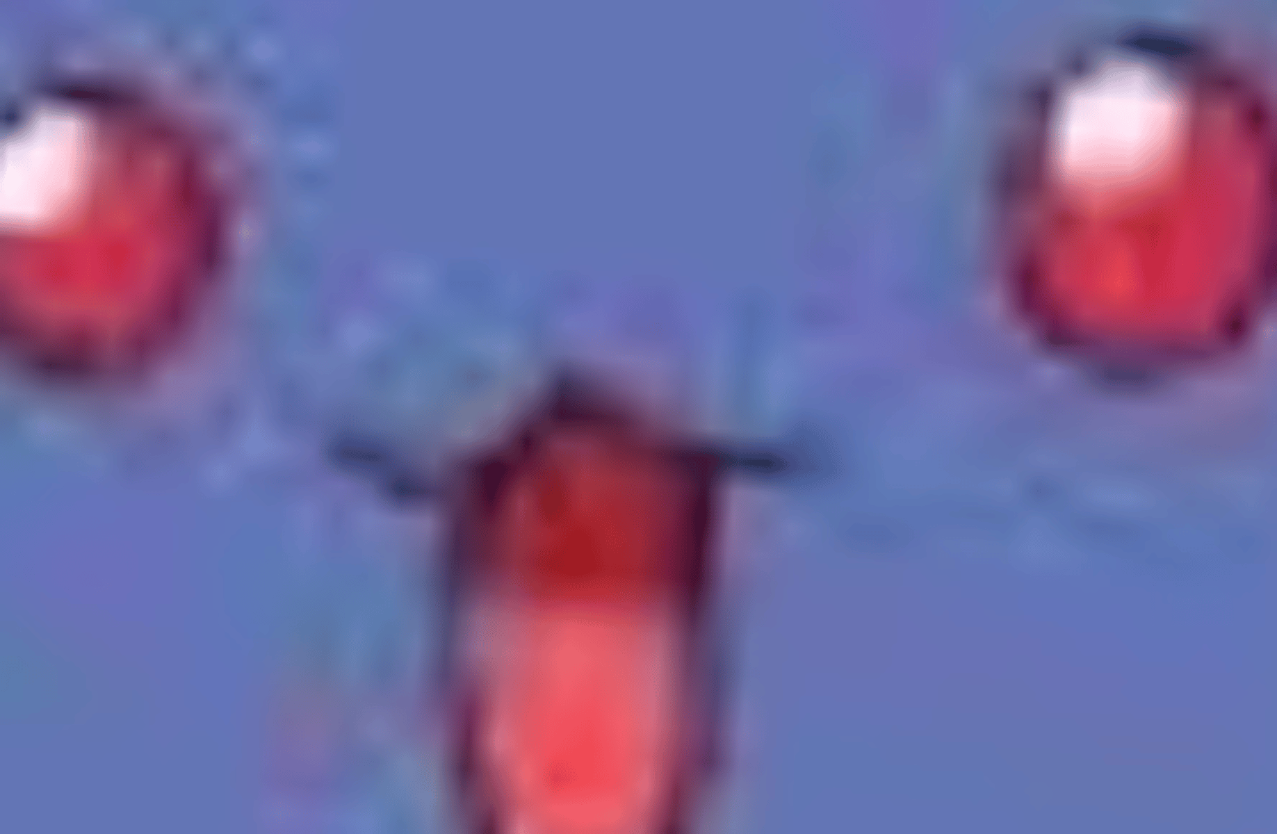 Jumpluff
