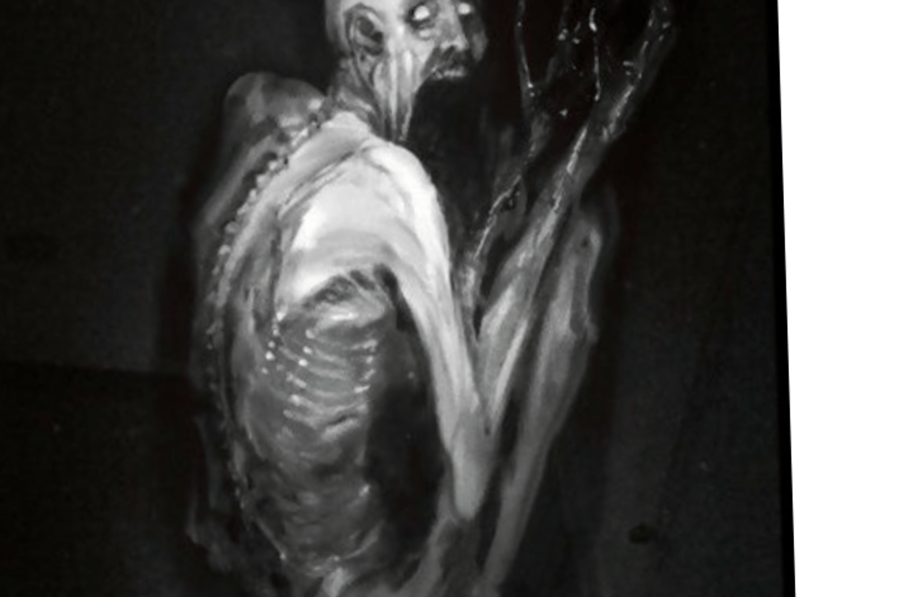 SCP-096
