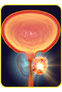 Benefit: Prostate Health