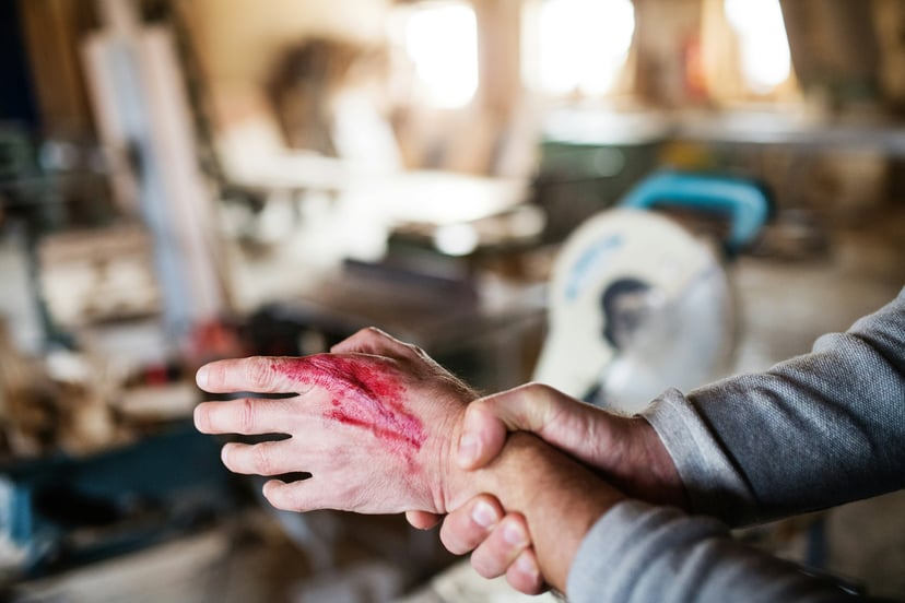 a man holding his hand which has some blood from a cut on it