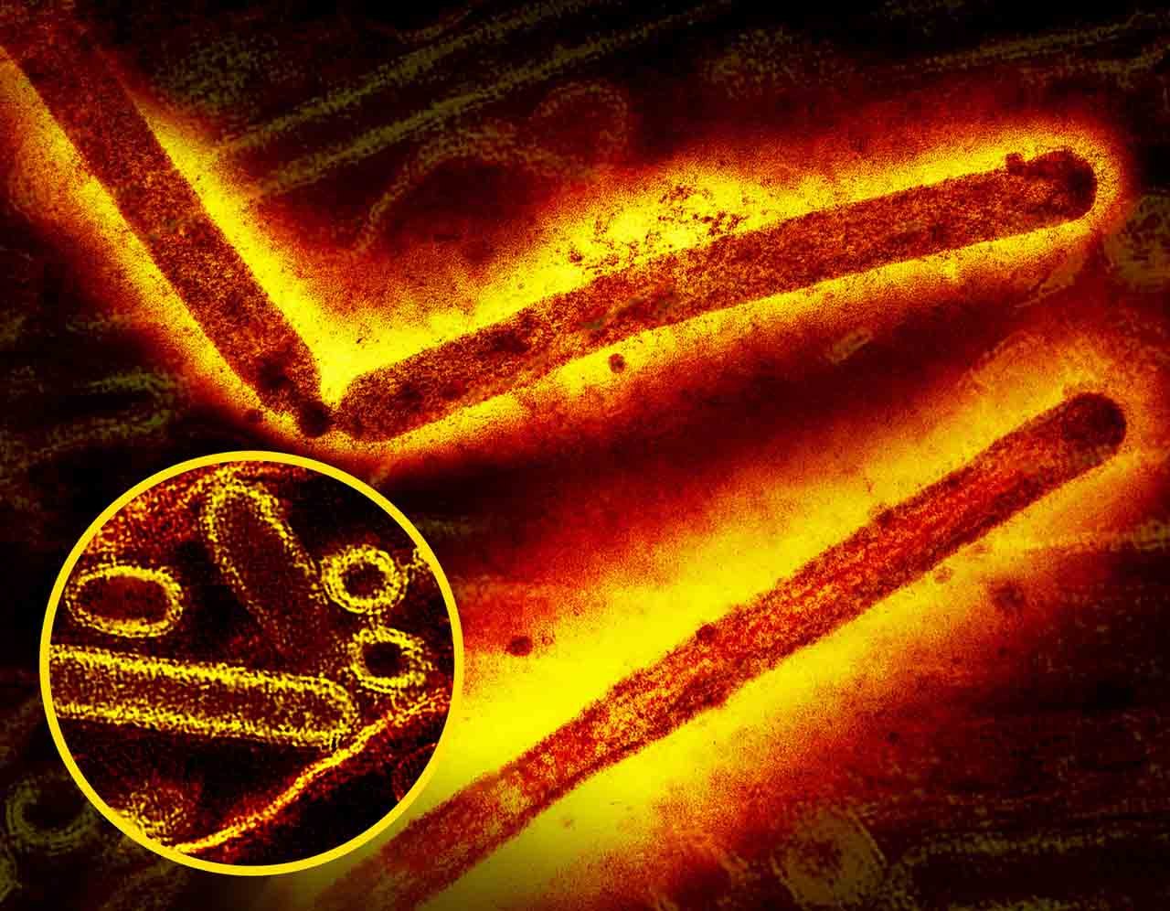 Influenza A Virus H5N1 Bird Flu
