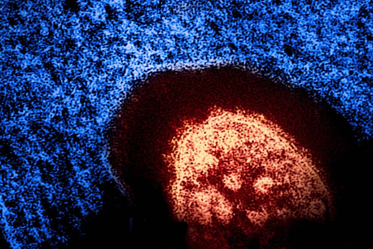 Measles Virus Particle